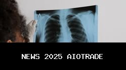 Capai 141 Persen! Penyebaran TBC Anak di Subang Melebihi Perkiraan