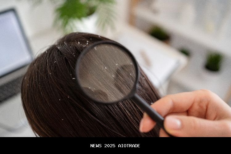 5 Cara Ampuh Atasi Ketombe, Rambut Segar dan Bersih