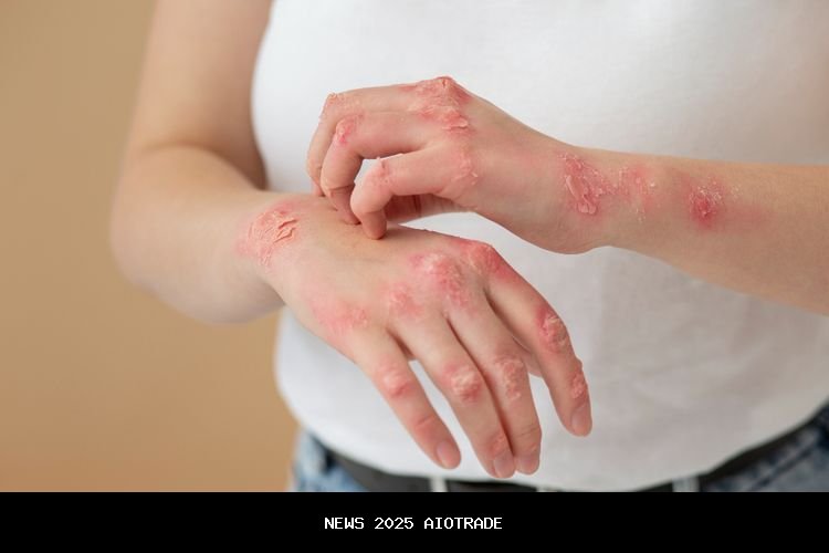 8 Cara Alami Mengatasi Kurap yang Efektif dan Praktis di Rumah