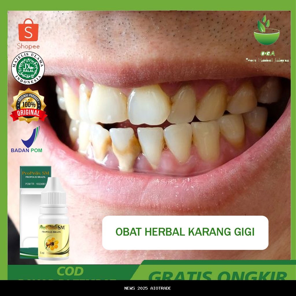 Bisakah Obat Kumur Menghilangkan Karang Gigi?