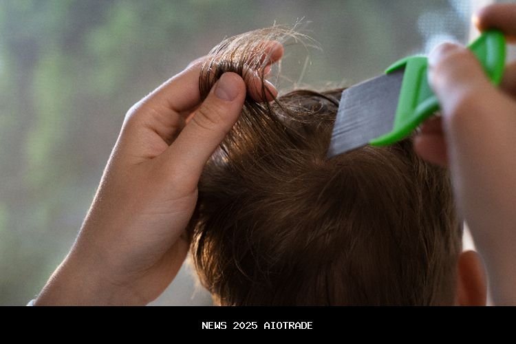 Kenali Tanda-Tanda Kutu Rambut dan Cepat Atasi dengan Solusi Aman