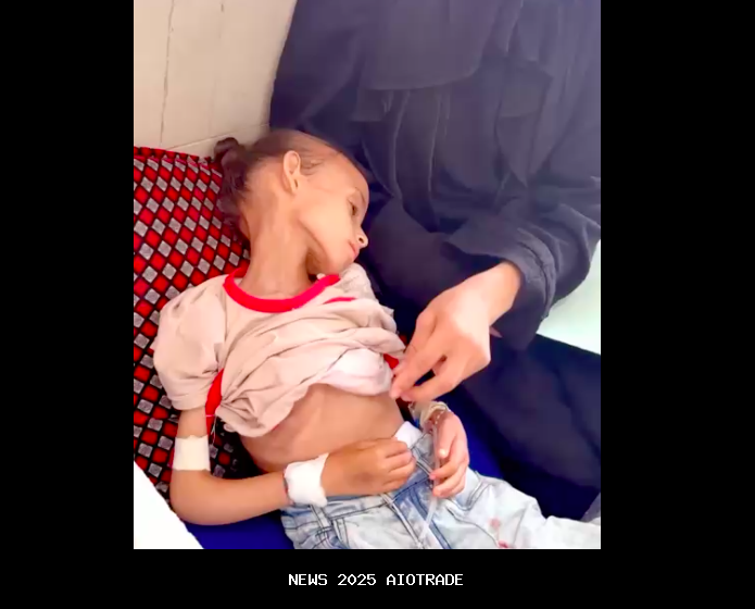 Warga Gaza Dilarang Berobat ke AS, Visa Ditinjau Ulang