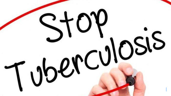 Langkah Diagnosis TBC yang Harus Diketahui Dokter