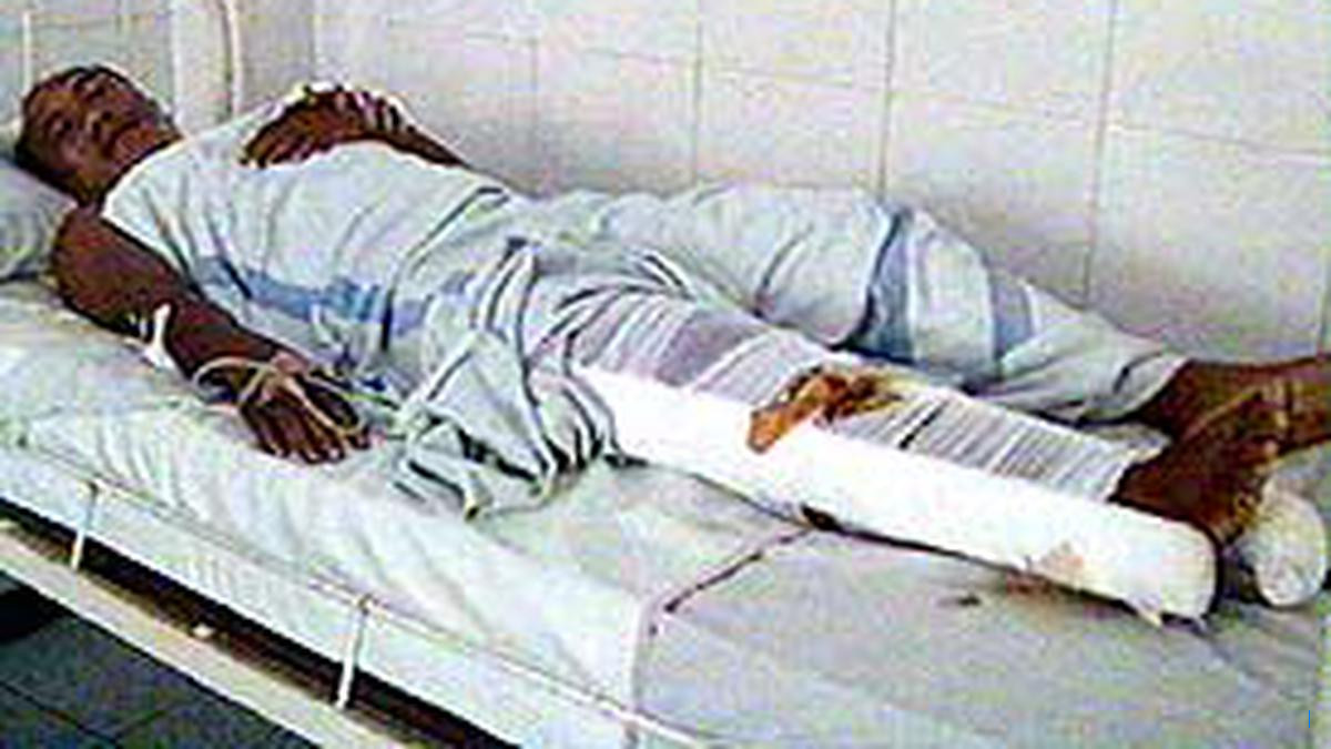 Empat Korban Tabrakan di Batu 8 Masih Dirawat di RSUD RAT