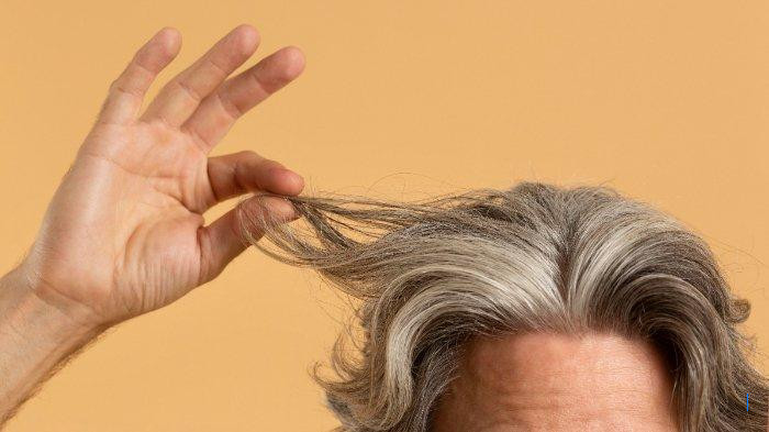 Dokter, Apakah Ada Pengobatan untuk Uban Dini?