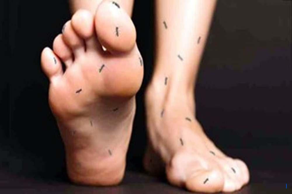 Gejala Kekurangan Vitamin B12 yang Umum